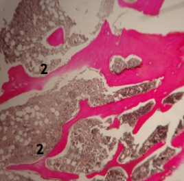ГИПОЭСТРОГЕННАЯ МОДЕЛЬ ОСТЕОПОРОЗА ДВУСТОРОННЯЯ ОВАРИОЭКТОМИЯ 2,5 МЕСЯЦА